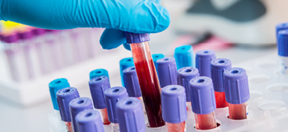 Hemoterapia